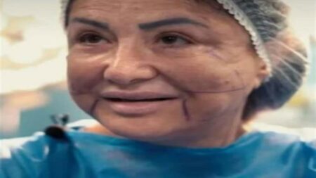 "صغرت 30 سنة”.. وفاء سالم في أول ظهور بعد إعلانها تعرض وجهها للتشوه بسبب التجميل