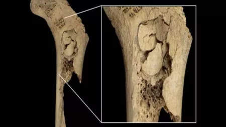 وليمة من لحوم البشر.. اكتشاف حادث مروع في إسبانيا "صور"