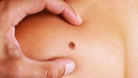 يصيب معظم الناس.. ما هو فيروس الورم الحليمي البشري الذي يهدد الرجال والنساء؟