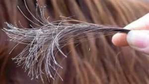 تقصف الشعر.. إليك الأسباب وطرق العلاج