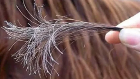 تقصف الشعر.. إليك الأسباب وطرق العلاج