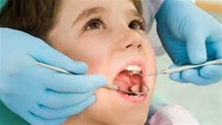 «صحة القاهرة»: تقديم خدمات طب الأسنان لاكثر من 53 الف مريض خلال مارس