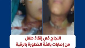 «معهد ناصر»: تدخل جراحي متعدد ينقذ طفلا من إصابة قاتلة بالرقبة