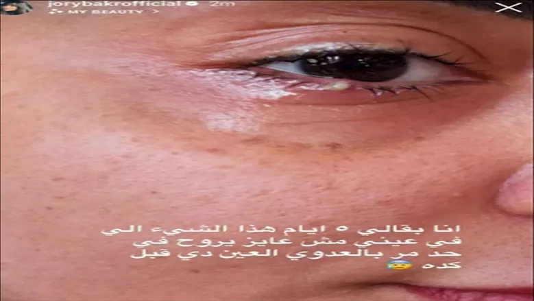 جوري بكر تعلن إصابتها بعدوى في عينها- ماذا قالت؟ 1 جوري بكر